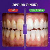 רצועות הלבנה סגולות של Smilevo — לשיניים רגישות, תוצאות תוך 7 ימים