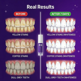 משחת הלבנה סגולה V34 של Smilevo — תיקון צבע
